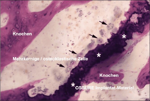 Gewebeabschnitt unter dem Mikroskop (aus der „Pre-Clinical Study“)